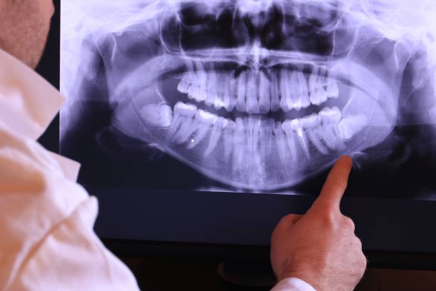 Best Emergency Dentist for Knocked-Out Tooth in Seco Mines, TX