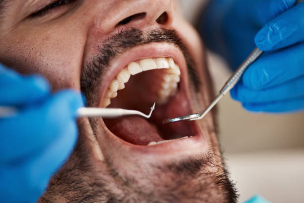 Best Orthodontic Emergency Dentist in Seco Mines, TX
